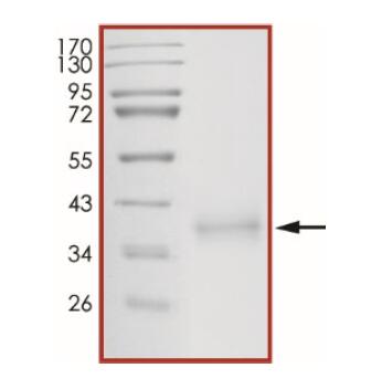 The purity of 2019-nCoV Spike protein S1 subunit, RBD (L452R T478K) was determined to be >90% by densitometry
